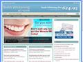 Home teeth whitening gel